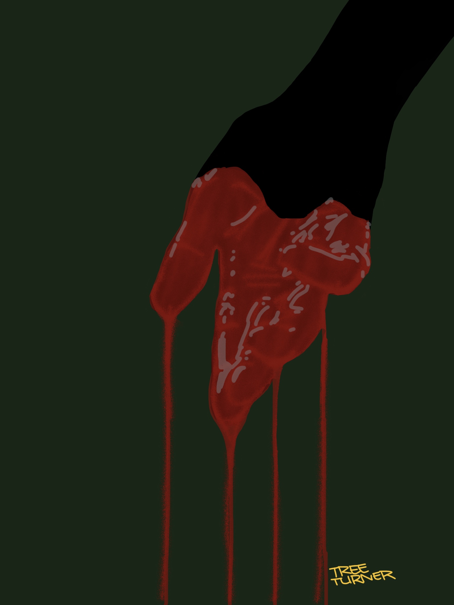 Blood on my hands.......